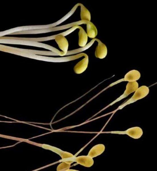 Meyve ve sebzelerin benzediği organlar 