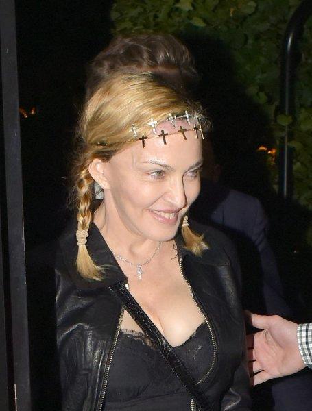 Madonna’nın yaşı ellerinden okunuyor 