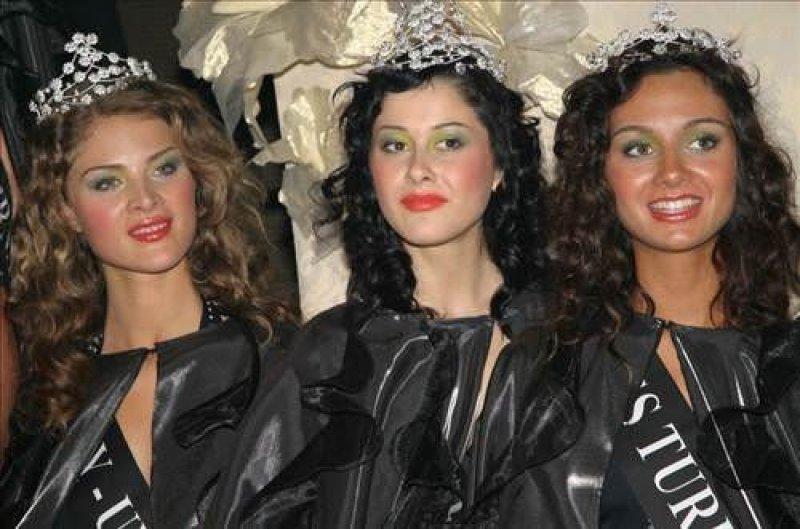 Birce Akalay'ın estetiksiz hali şaşırttı 