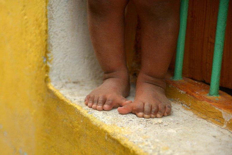 Hindistanlı Choudhary sülalesinin tamamı 6 parmaklı 