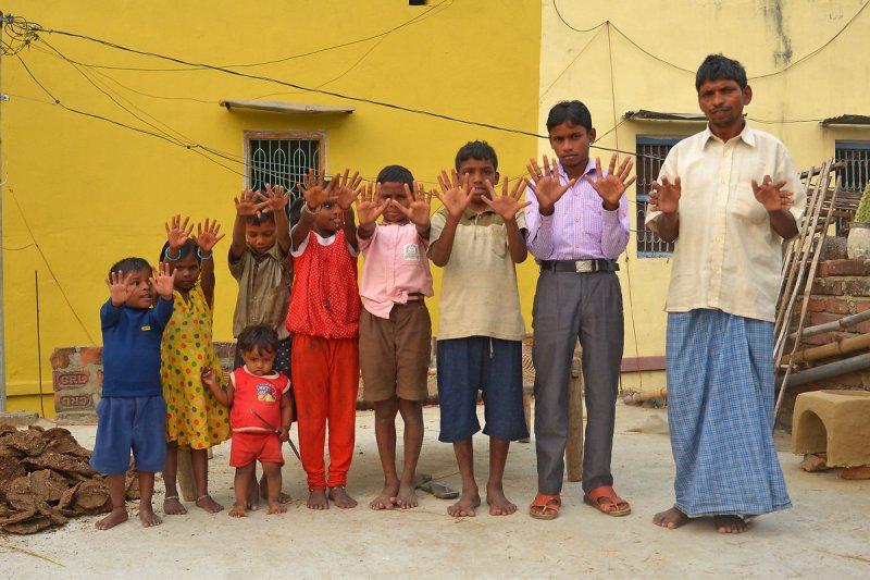 Hindistanlı Choudhary sülalesinin tamamı 6 parmaklı 