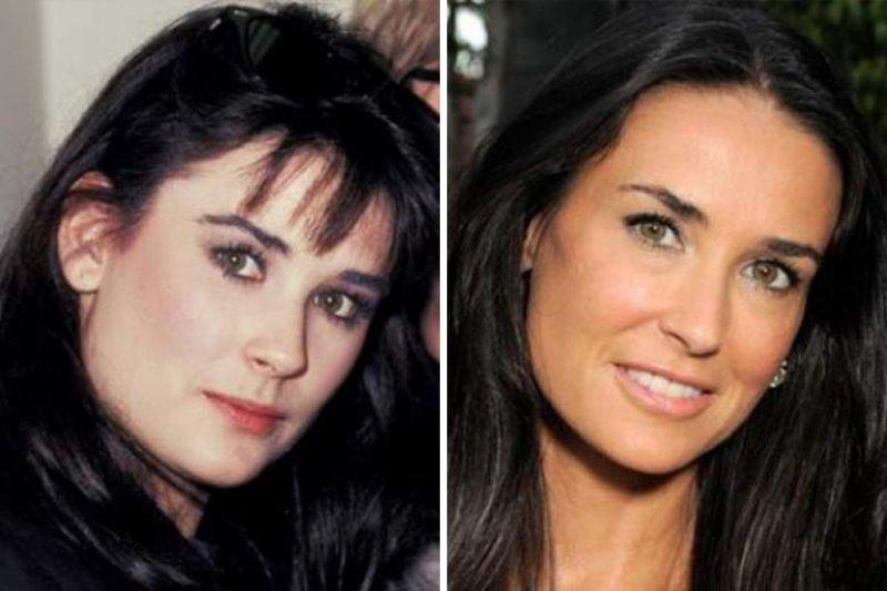 Ünlülerin yaptırdığı en pahalı estetikler  