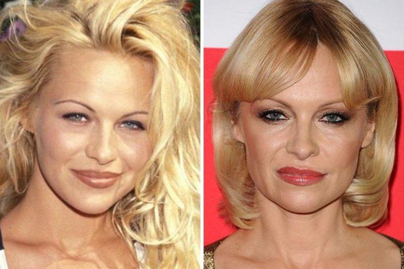 Ünlülerin yaptırdığı en pahalı estetikler  