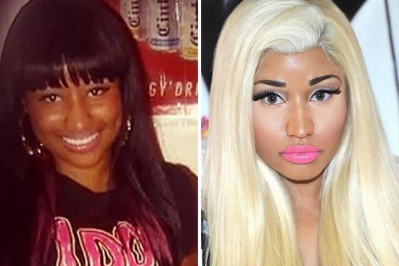 Ünlülerin yaptırdığı en pahalı estetikler  