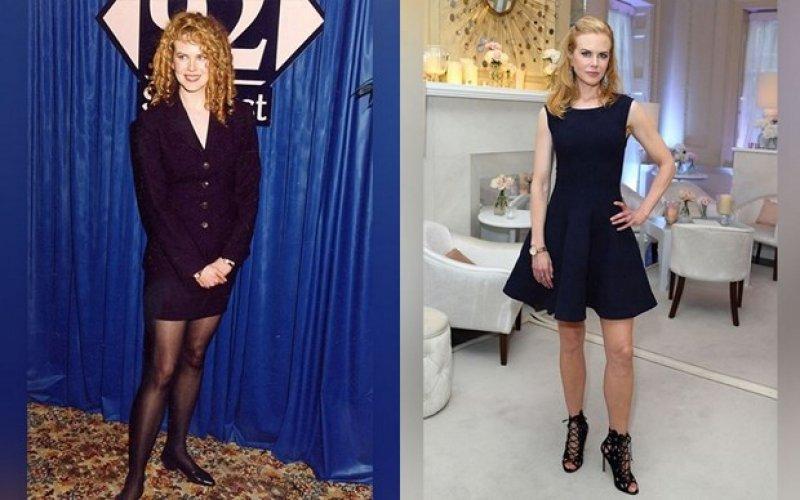 Ünlülerin eski ve yeni halleri