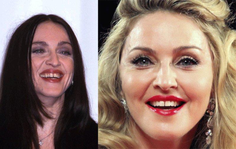 Ünlülerin eski ve yeni halleri