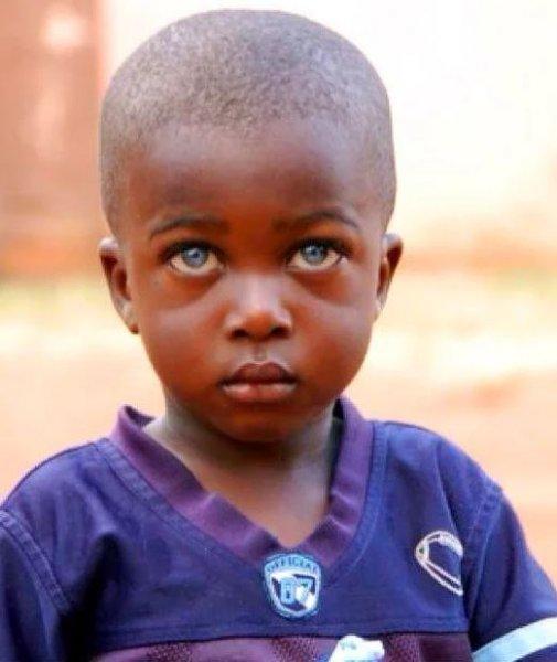 Mavi gözlü siyahi çocuklar 