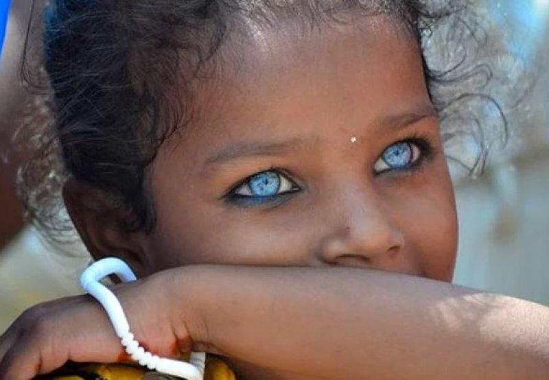 Mavi gözlü siyahi çocuklar 