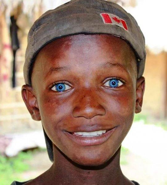 Mavi gözlü siyahi çocuklar 