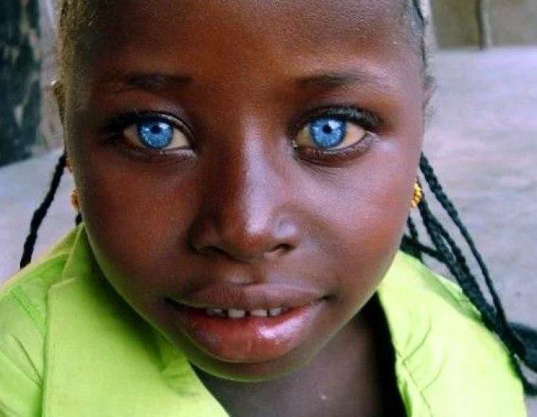 Mavi gözlü siyahi çocuklar 