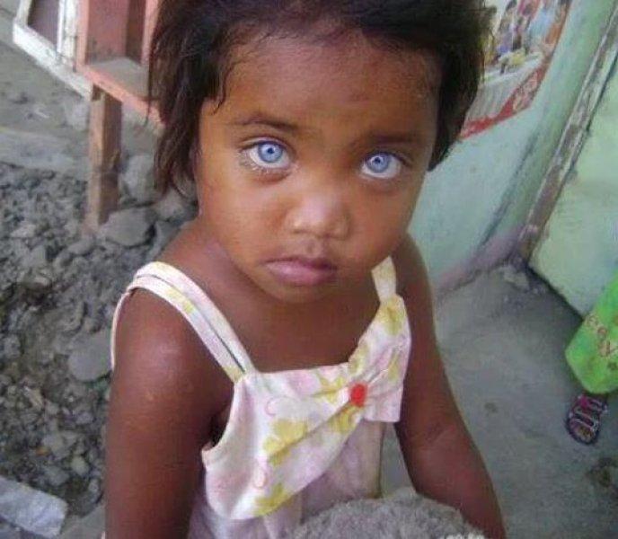 Mavi gözlü siyahi çocuklar 