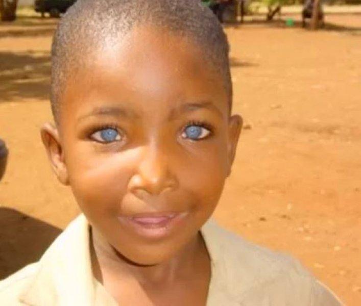 Mavi gözlü siyahi çocuklar 