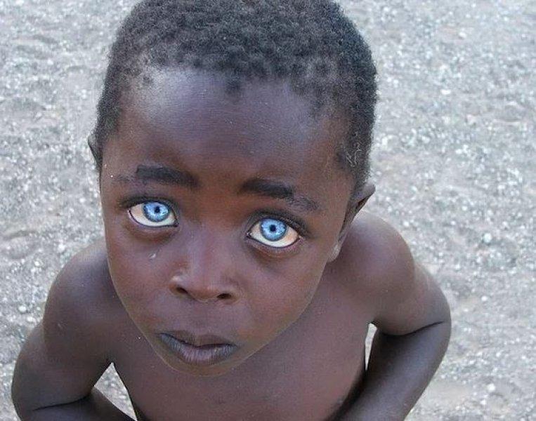 Mavi gözlü siyahi çocuklar 