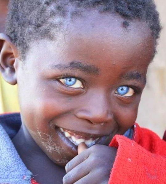 Mavi gözlü siyahi çocuklar 