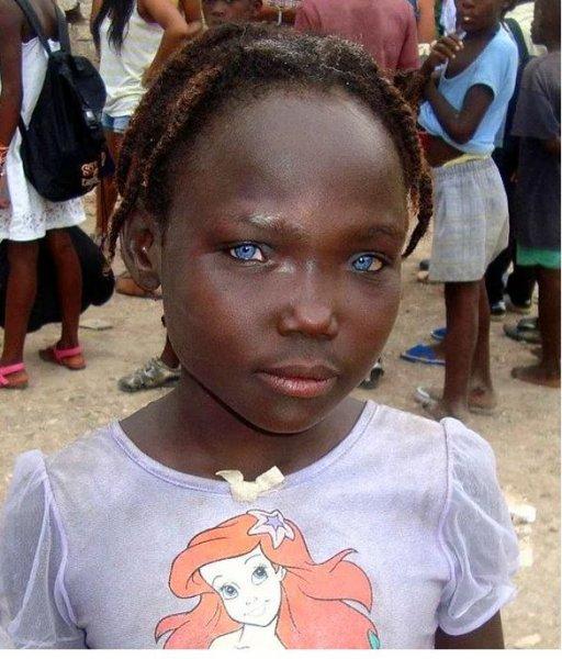 Mavi gözlü siyahi çocuklar 