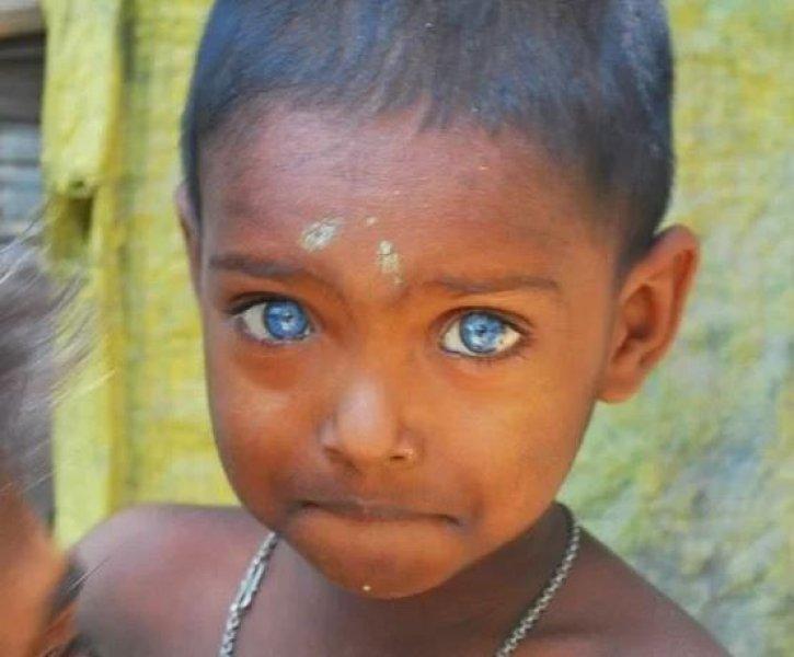 Mavi gözlü siyahi çocuklar 