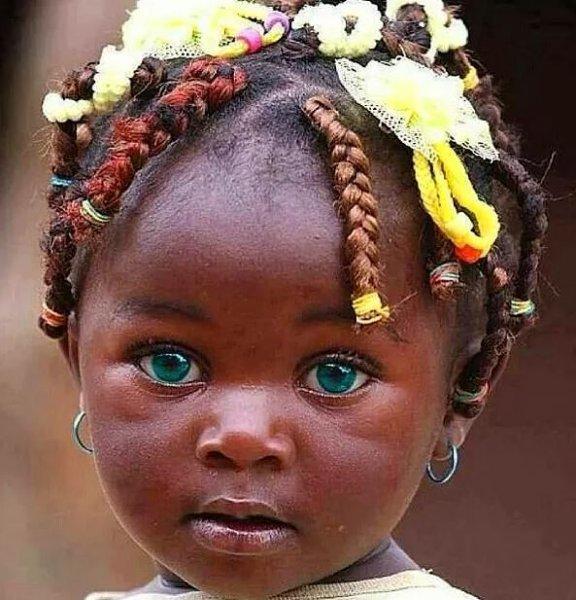 Mavi gözlü siyahi çocuklar 