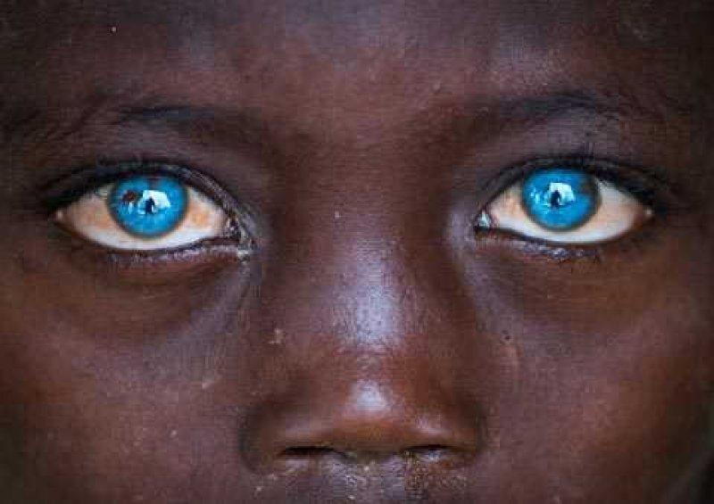 Mavi gözlü siyahi çocuklar 