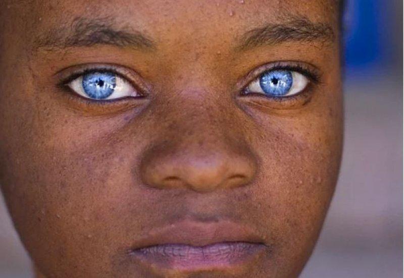 Mavi gözlü siyahi çocuklar 