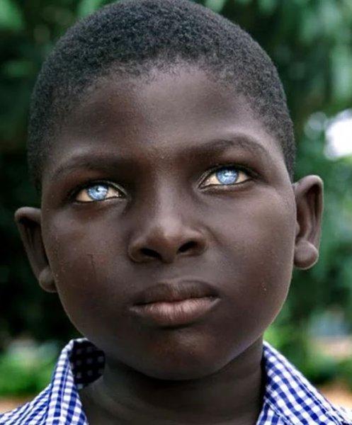 Mavi gözlü siyahi çocuklar 