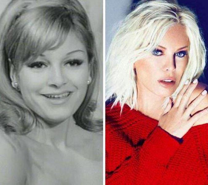 Estetik harikası ünlüler 