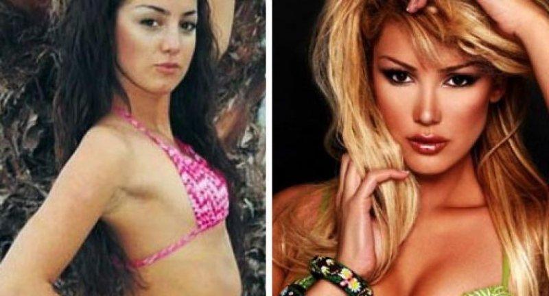 Estetik harikası ünlüler 