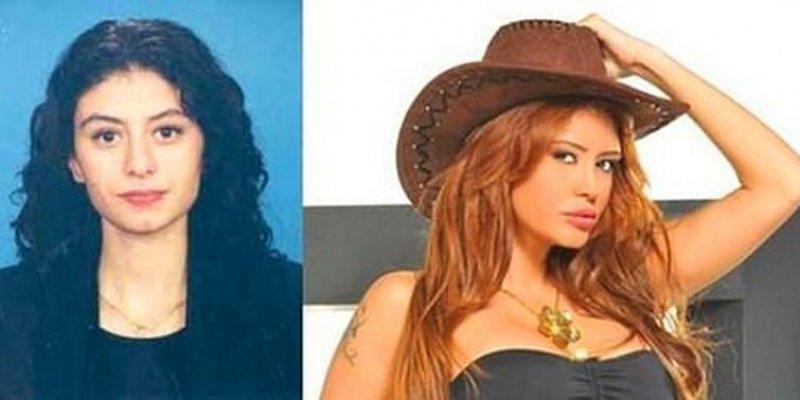 Estetik harikası ünlüler 