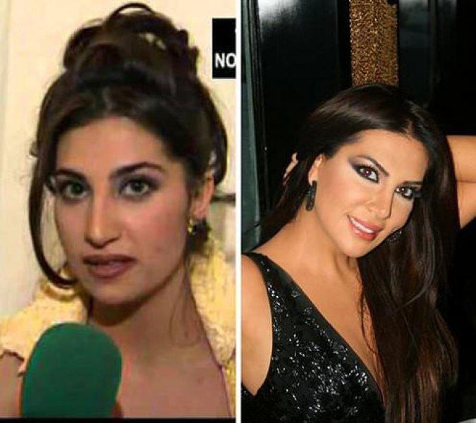 Estetik harikası ünlüler 