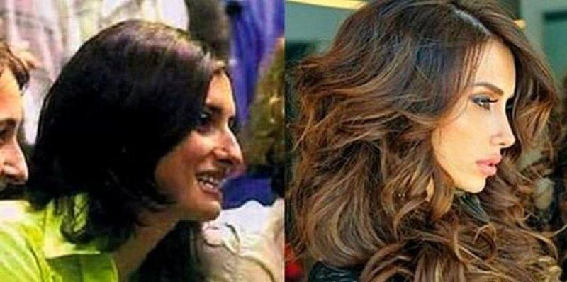 Estetik harikası ünlüler 