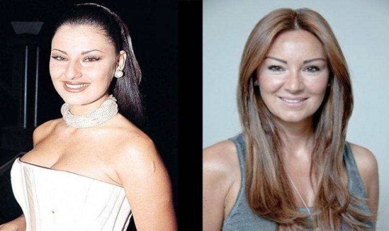 Estetik harikası ünlüler 