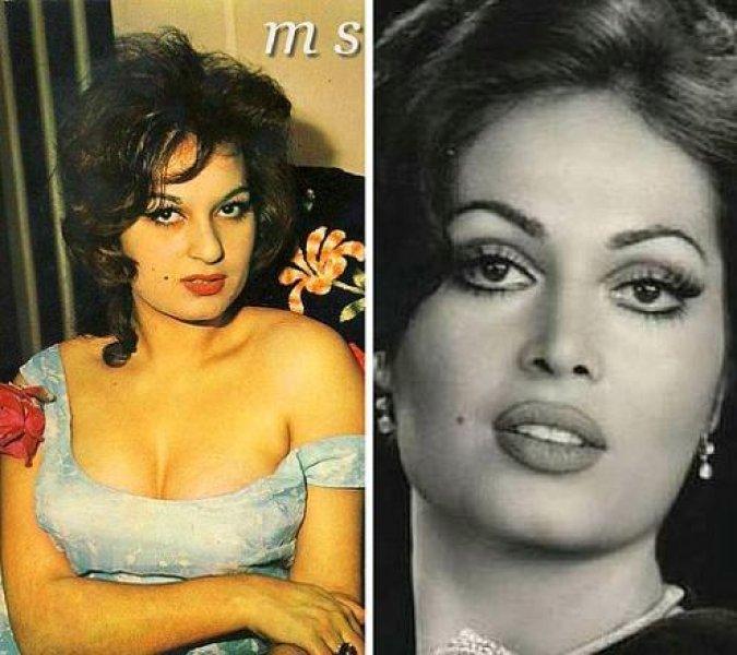 Estetik harikası ünlüler 