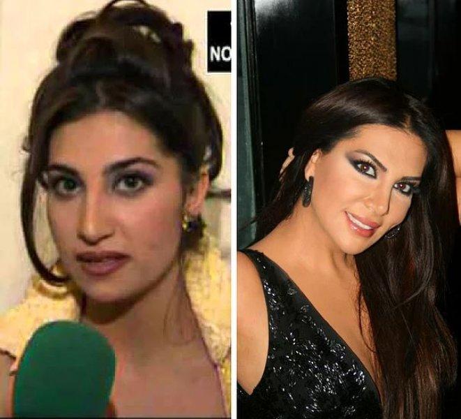 Estetik operasyonlarla başka birine dönüşen ünlüler 