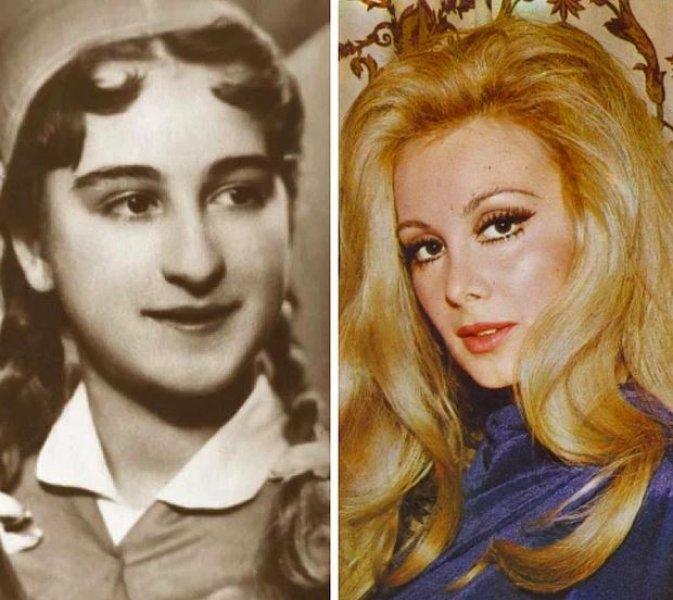 Estetik operasyonlarla başka birine dönüşen ünlüler 