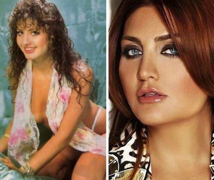 Estetik operasyonlarla başka birine dönüşen ünlüler 