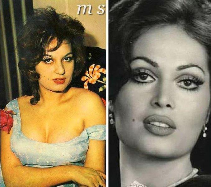 Estetik operasyonlarla başka birine dönüşen ünlüler 