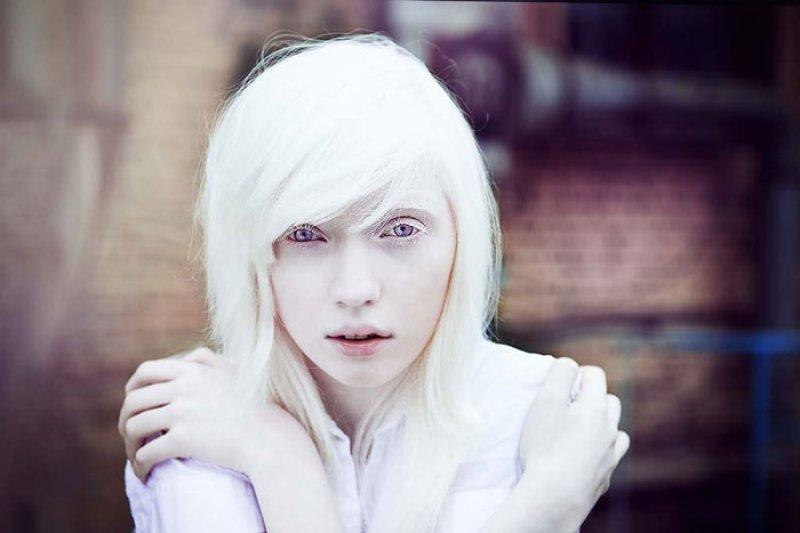 Benzersiz ten rengine sahip 8 farklı insan