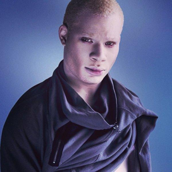 Benzersiz ten rengine sahip 8 farklı insan