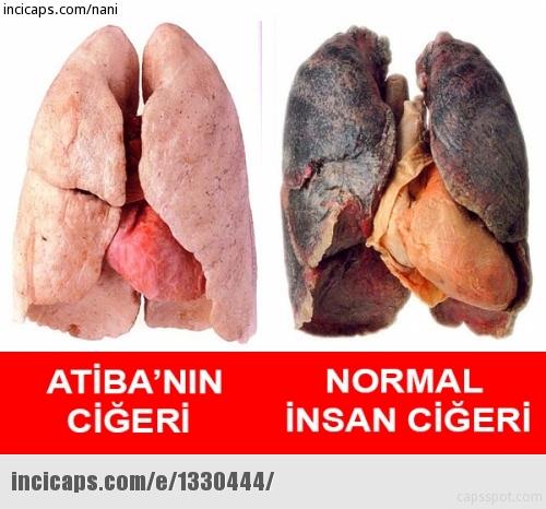 Trabzonspor-Beşiktaş maçının capsleri