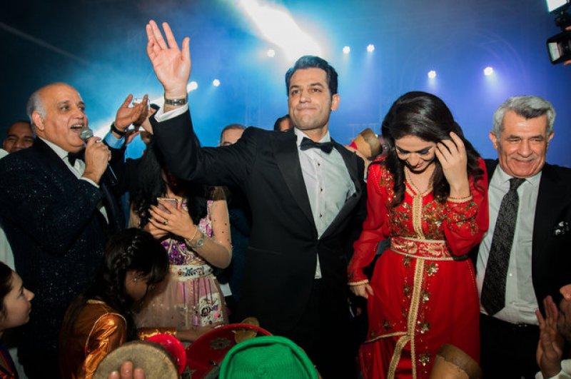 İmane Elbani'nin bakımsız tırnakları olay oldu 