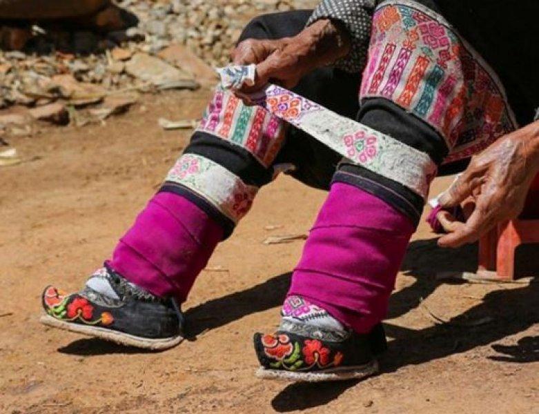 Çinli kadınların güzellik uğruna çektiği eziyet 