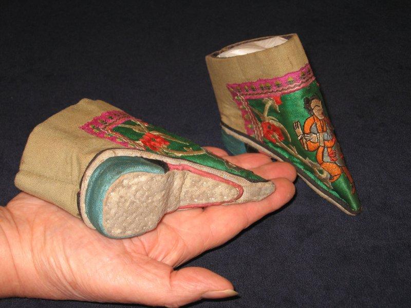 Çinli kadınların güzellik uğruna çektiği eziyet 