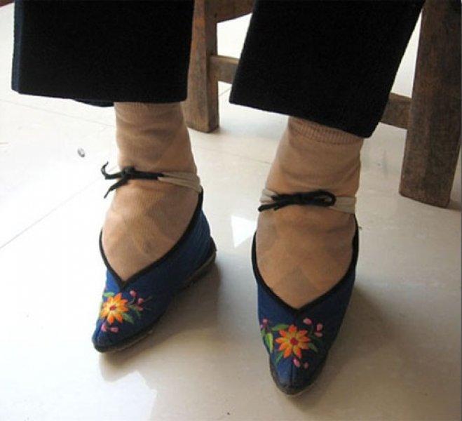 Çinli kadınların güzellik uğruna çektiği eziyet 