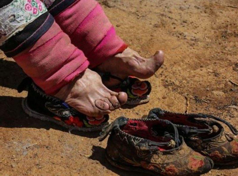 Çinli kadınların güzellik uğruna çektiği eziyet 