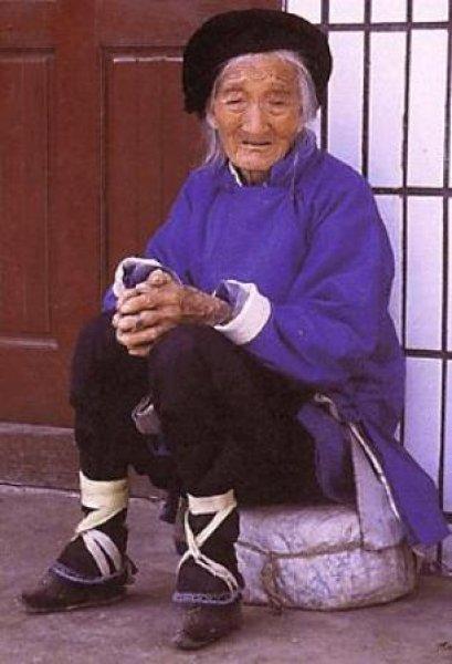 Çinli kadınların güzellik uğruna çektiği eziyet 