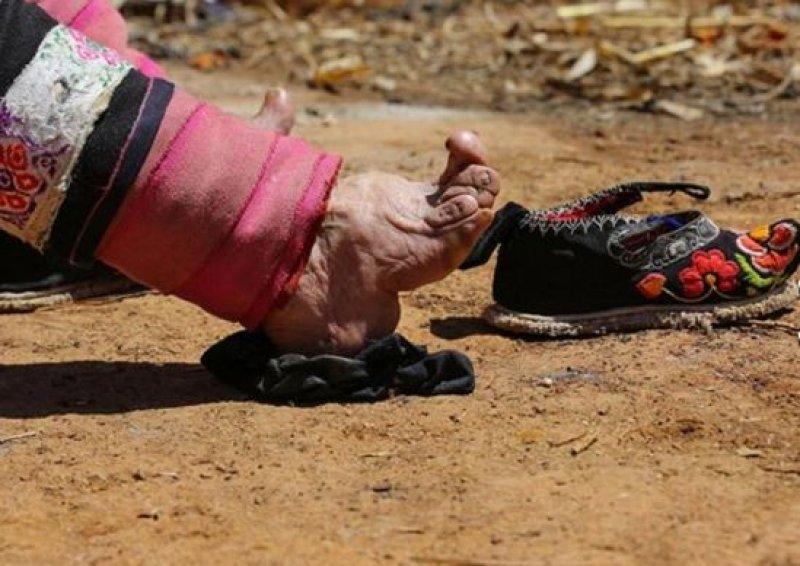 Çinli kadınların güzellik uğruna çektiği eziyet 