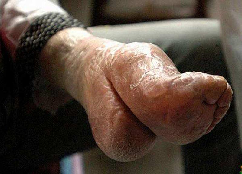 Çinli kadınların güzellik uğruna çektiği eziyet 