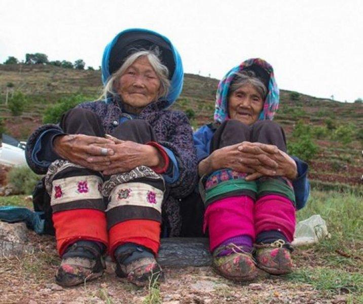 Çinli kadınların güzellik uğruna çektiği eziyet 