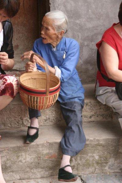 Çinli kadınların güzellik uğruna çektiği eziyet 