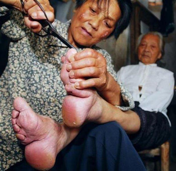 Çinli kadınların güzellik uğruna çektiği eziyet 