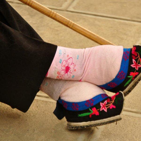 Çinli kadınların güzellik uğruna çektiği eziyet 